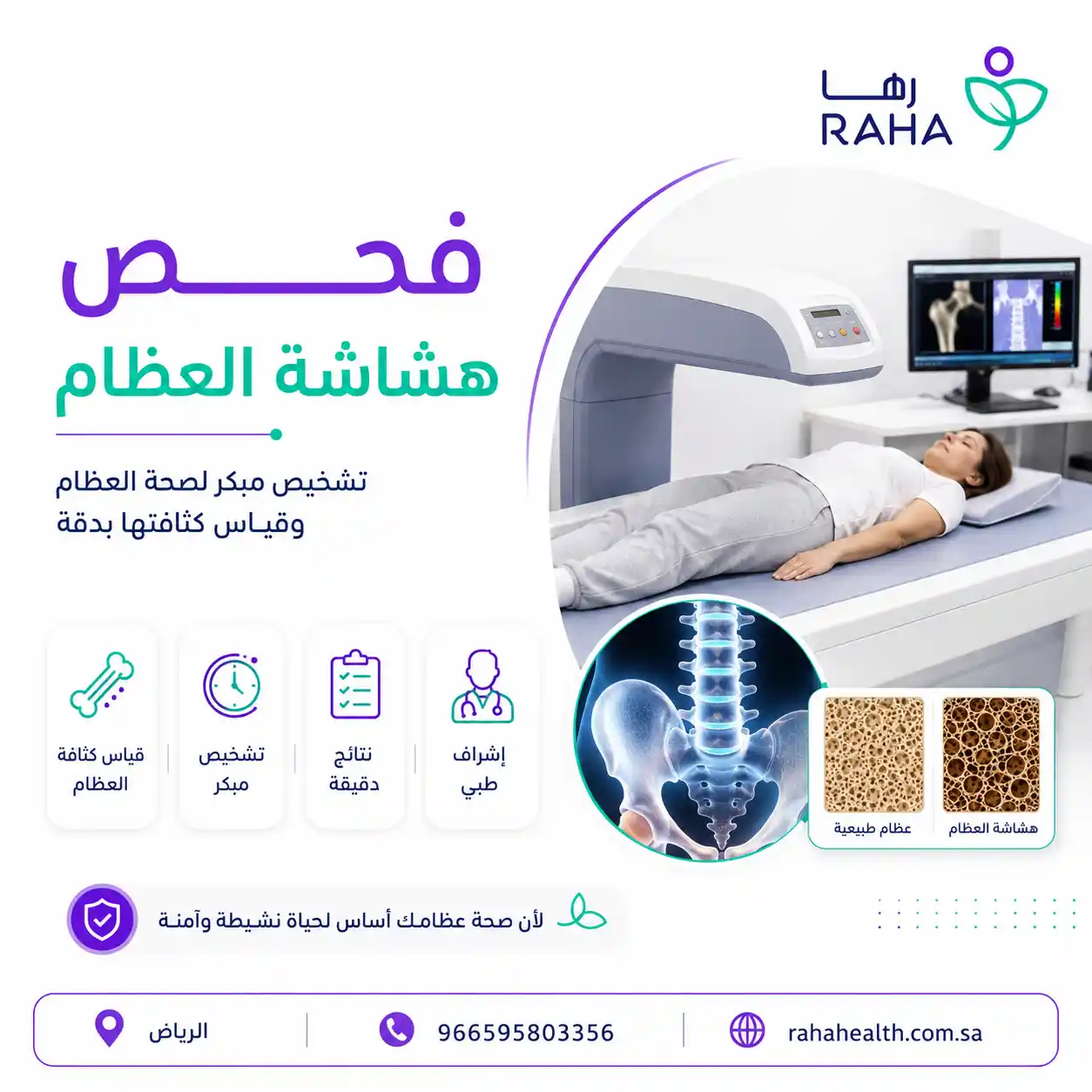 فحص هشاشة العظام